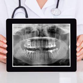 Digital X-rays